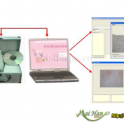 Máy kiểm tra da và tóc kết nối vi tính 6100U Máy kiểm tra da và tóc kết nối vi tính 6100U