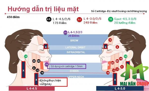 Hướng dẫn trị liệu cho vùng mặt
