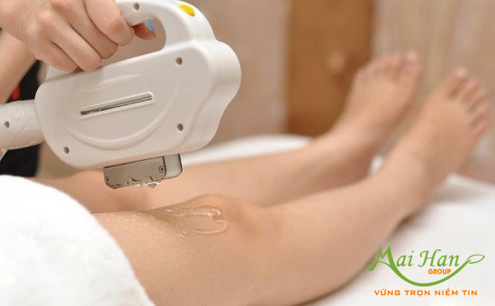 Những tiêu chí triệt lông tiết kiệm và hiệu quả với máy triệt lông