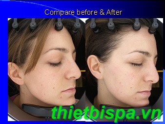 Máy phân tích da - cho hiệu quả trung thực nhất mang lại rất nhiều công dụng hữu hiệu Máy phân tích da - cho hiệu quả trung thực nhất mang lại rất nhiều công dụng hữu hiệu