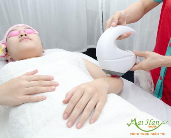 Ưu, nhược điểm của từng phương pháp triệt lông bằng IPL