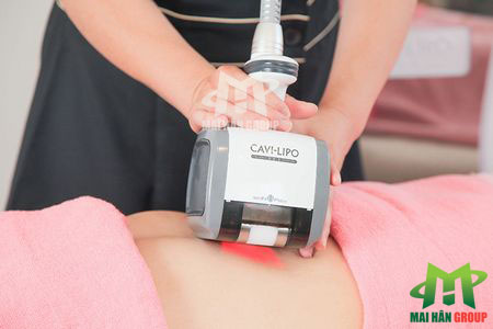 Máy giảm cân Cavi-Lipo V-Dex tác dụng và an toàn hơn cả mong đợi