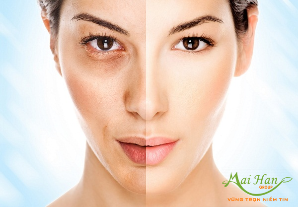 Trị nám như thế nào là hiệu quả và đúng cách? Trị nám như thế nào là hiệu quả và đúng cách?