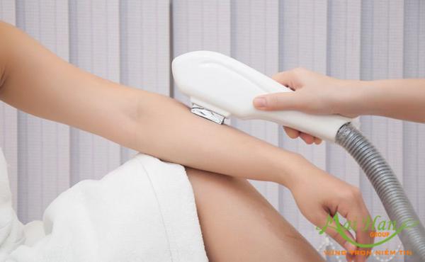 Triệt lông tại nhà và những mối nguy hiểm rình rập