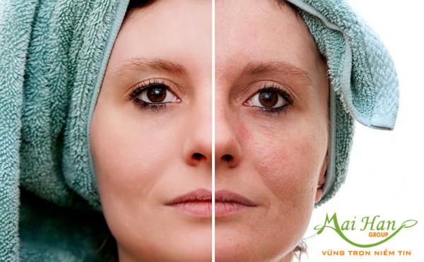 Tái tạo làn da với phương pháp điều trị khiếm khuyết da với máy siêu mài mòn cát và kim cương NV-900