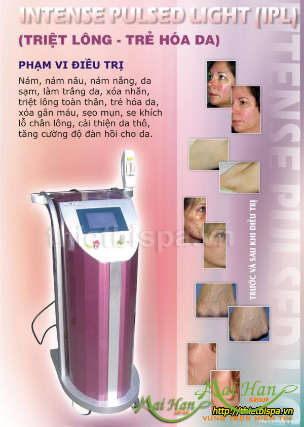 Triệt lông vĩnh viễn với công nhệ IPL 