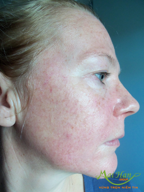 Máy xông hơi làm đẹp da mặt Máy xông hơi làm đẹp da mặt