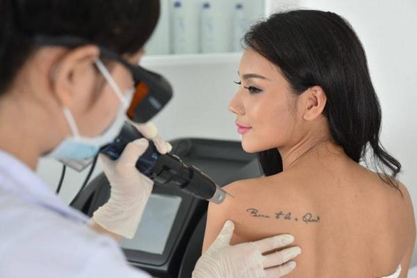 SỞ HỮU NGAY MÁY XÓA XĂM CÔNG NGHỆ HÀNG ĐẦU HOA KỲ SỞ HỮU NGAY MÁY XÓA XĂM CÔNG NGHỆ HÀNG ĐẦU HOA KỲ