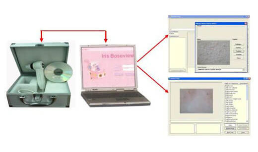Máy được kết nối với máy tính để cho ra hình ảnh