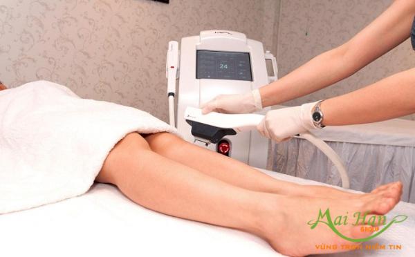 Triệt lông vĩnh viễn: dễ hay khó với máy wax lông Triệt lông vĩnh viễn: dễ hay khó với máy wax lông