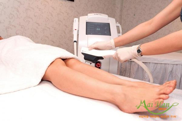 Hiệu quả tới 95% với công nghệ triệt lông tiên tiến 6G mang đến sự hài lòng cho các chị em