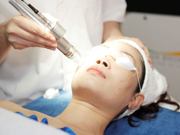 Fractional CO2 Laser mang lại làn da đẹp mịn màng cho chị em