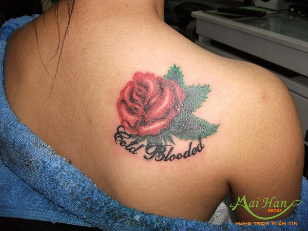 Xóa xăm – những sai lầm cần tránh Xóa xăm – những sai lầm cần tránh