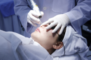 Phương pháp điều trị sẹo rỗ, sẹo lõm hiệu quả cho da