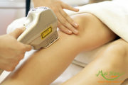 Cách triệt lông nào là hiệu quả?